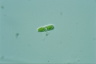 Cylindrocystis