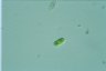 Cylindrocystis