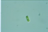 Cylindrocystis