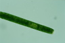 Pleurotaenium trabecula