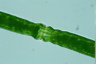 Pleurotaenium trabecula