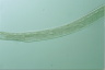 Spirostomum ambiguum