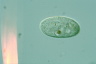 Frontonia depressa