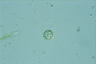 Pterocystis