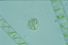 Acanthocystis