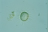 Acanthocystis