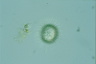 Acanthocystis