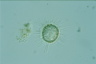 Acanthocystis