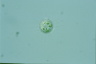 Acanthocystis