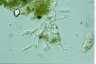 Thalassomyxa