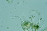 Thalassomyxa