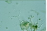 Thalassomyxa