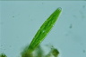 Closterium libellula