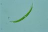 Closterium dianae