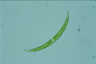 Closterium dianae