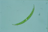 Closterium dianae