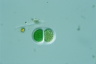 Chroococcus turgidus