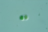 Chroococcus turgidus