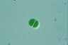 Chroococcus turgidus