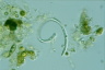 Ophiocytium parvulum