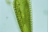 Surirella robusta