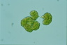 Botryococcus braunii