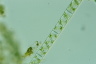 Spirogyra