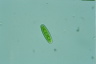 Closterium navicula