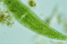 Closterium ehrenbergii