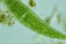 Closterium ehrenbergii