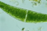 Closterium ehrenbergii