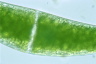 Closterium ehrenbergii