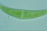 Closterium moniliferum