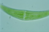 Closterium moniliferum