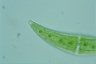 Closterium moniliferum