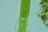 Closterium acerosum