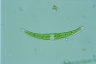 Closterium dianae