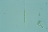 Closterium idiosporum