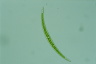 Closterium dianae