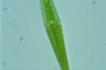 Closterium ralfsii