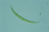 Closterium dianae