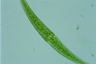 Closterium rostratum