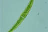 Closterium rostratum