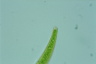 Closterium rostratum