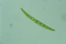 Closterium intermedium