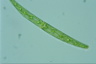 Closterium intermedium