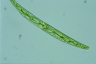 Closterium intermedium