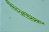 Closterium intermedium