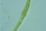 Closterium rostratum