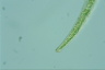 Closterium rostratum